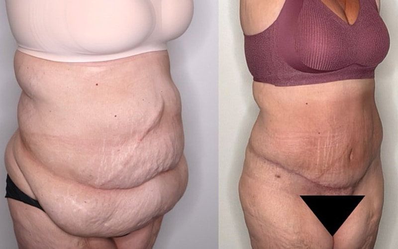 Body transformation before and after comparison.