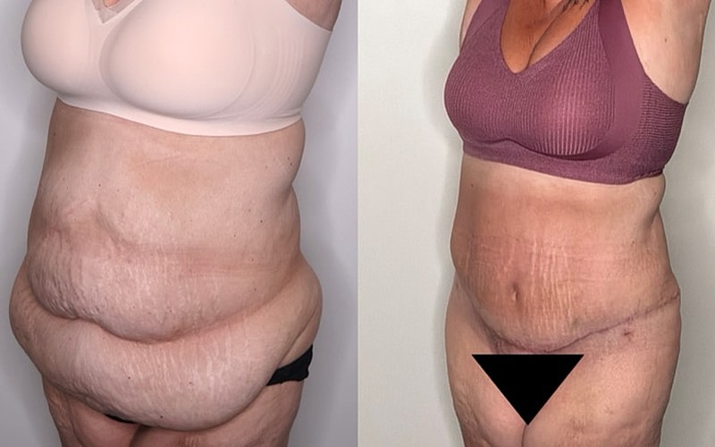 Before and after body transformation comparison.