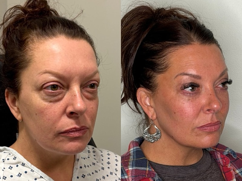 Before and after facial transformation comparison.