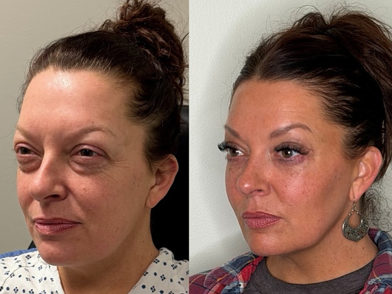 Before and after cosmetic transformation side-by-side.