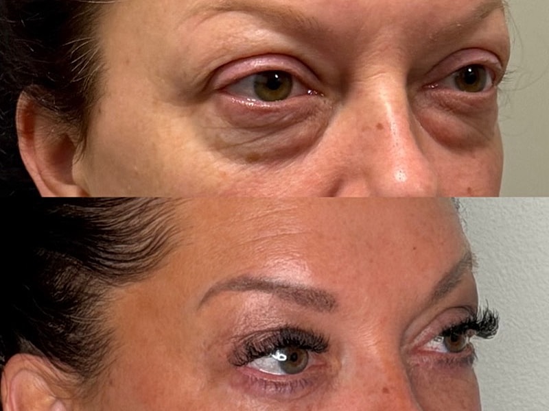 Before and after eye enhancement comparison.