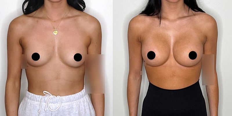 Before and after body transformation comparison.