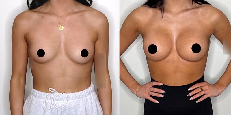 Before and after body transformation comparison.