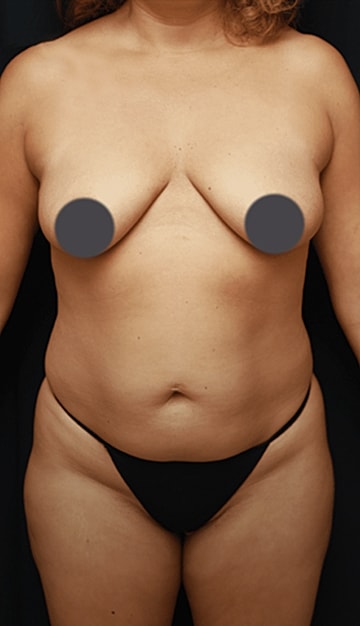 Before and after body image comparison.