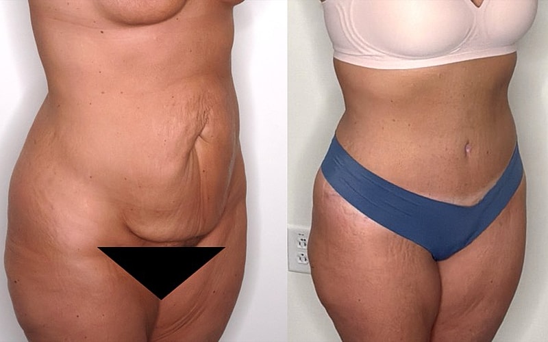 Transformation before and after body modification.