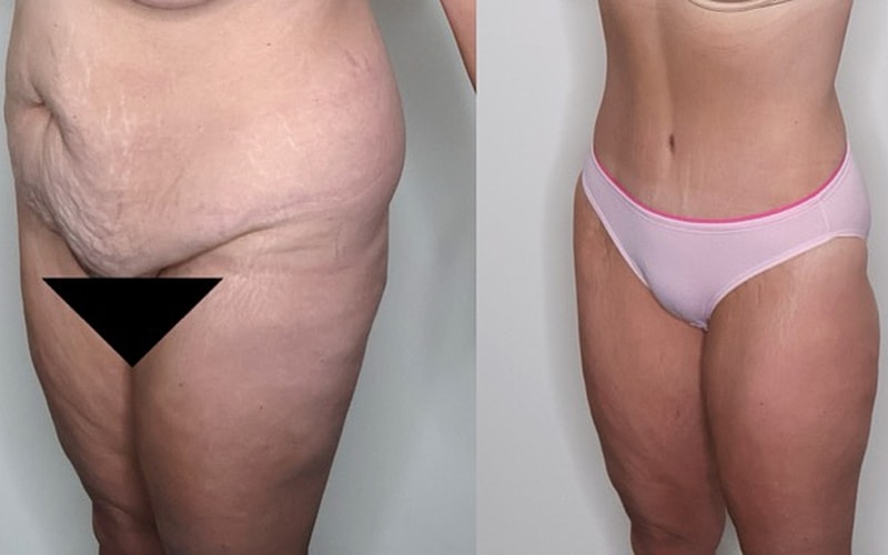 Before and after skin appearance comparison.