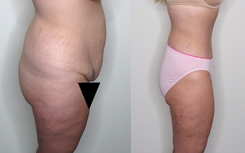 Before and after body transformation comparison