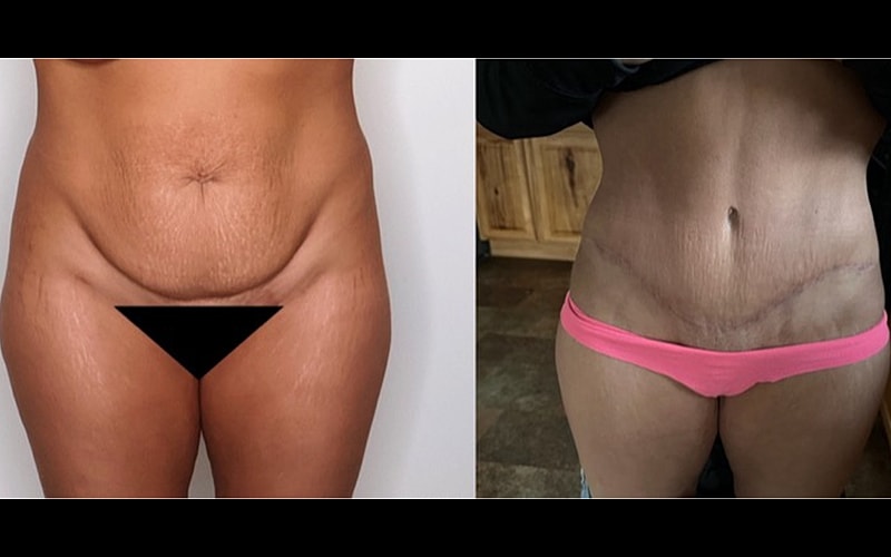 Before and after body transformation images.