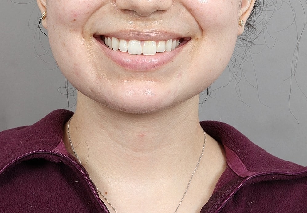 Close-up of a person's chin and lips.