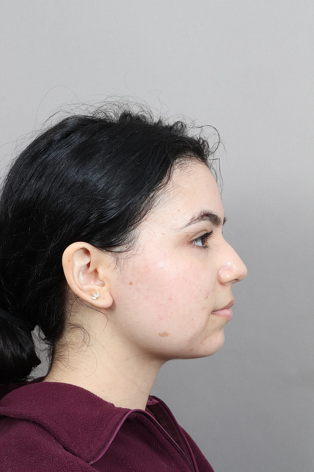 Profile view of a person in a jacket.