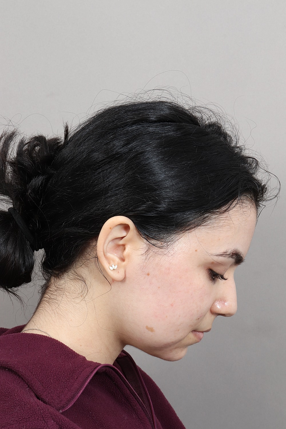 Close-up of woman's jaw and neck area.