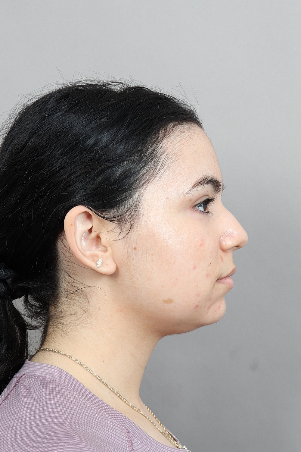 Profile view of a person with chin visible.