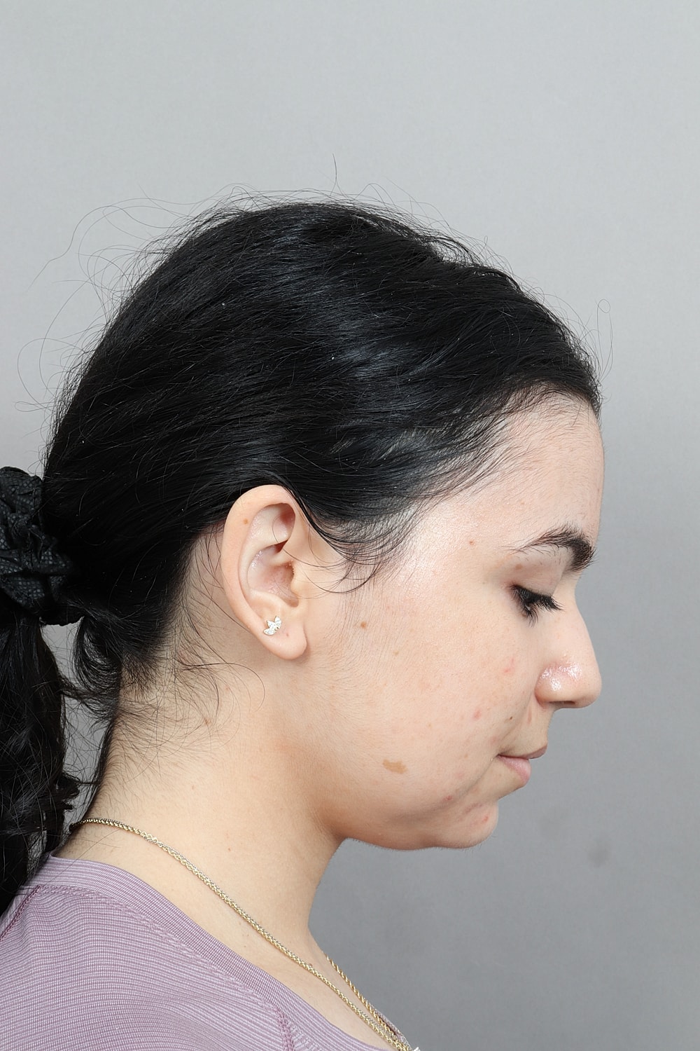 Close-up of a woman's lower face.