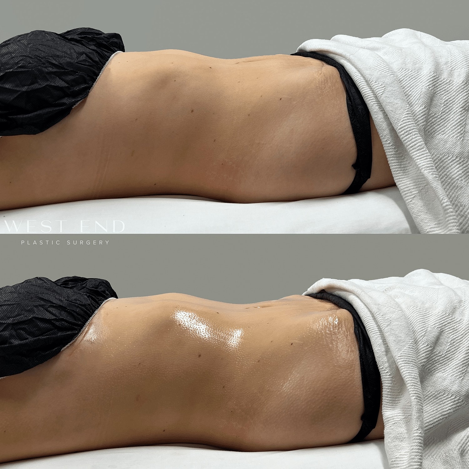 Before and after plastic surgery treatment comparison.