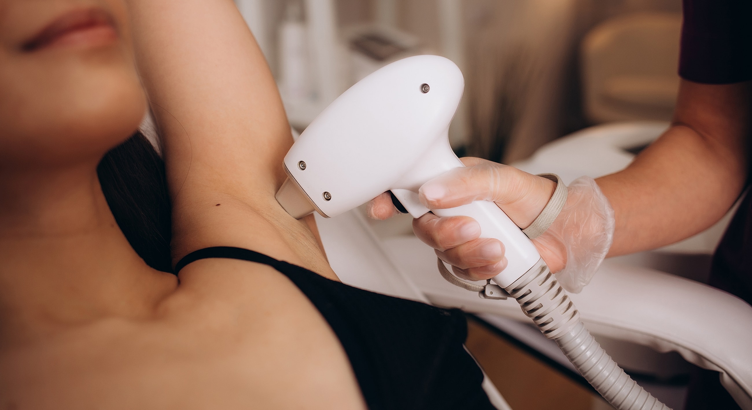 Laser hair removal treatment in progress.